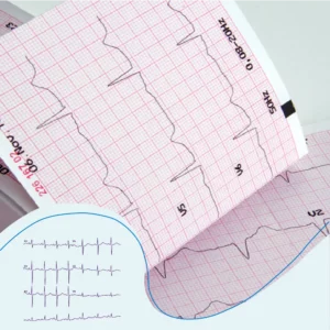 Lesdag praktisch ECG's beoordelen